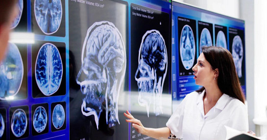 doctor looking at CNS scan