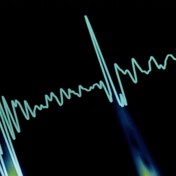 Cardiovascular research and treatment solutions