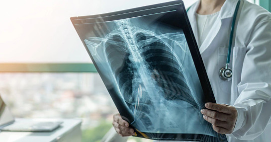 carcinoma scan doctor