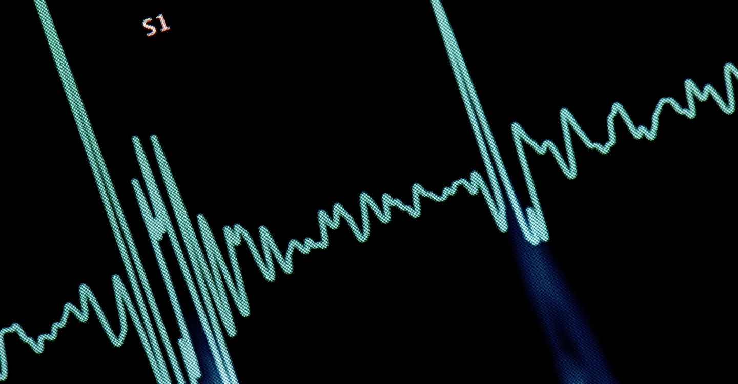 Cardiac monitoring equipment for patient safety