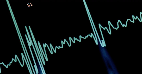 Cardiac monitoring equipment for patient safety