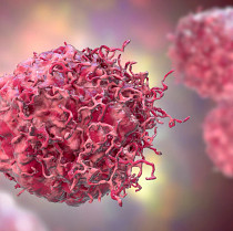 Cancer specialist presenting research findings