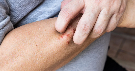 Clinical research in dermatology treatments