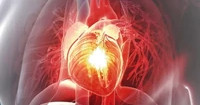 Cardiovascular trial management tools