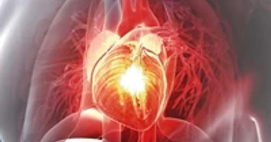 Cardiovascular trial management tools