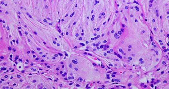 Digital histopathology laboratory services