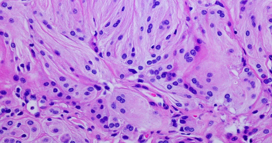 Digital histopathology laboratory services