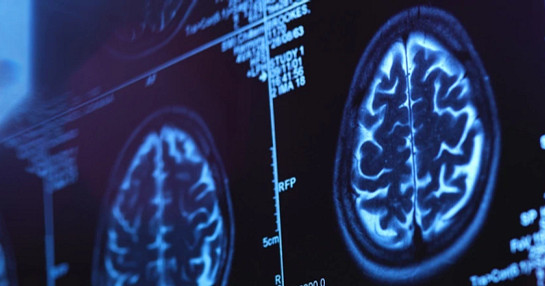 CNS imaging for neurological studies.