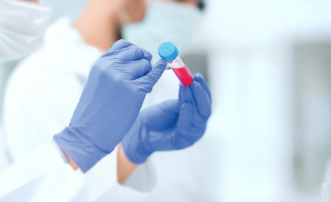 lab test tube sample