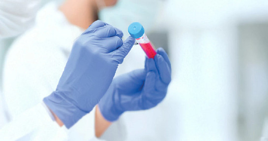 lab test tube sample