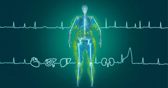 obesity scan person