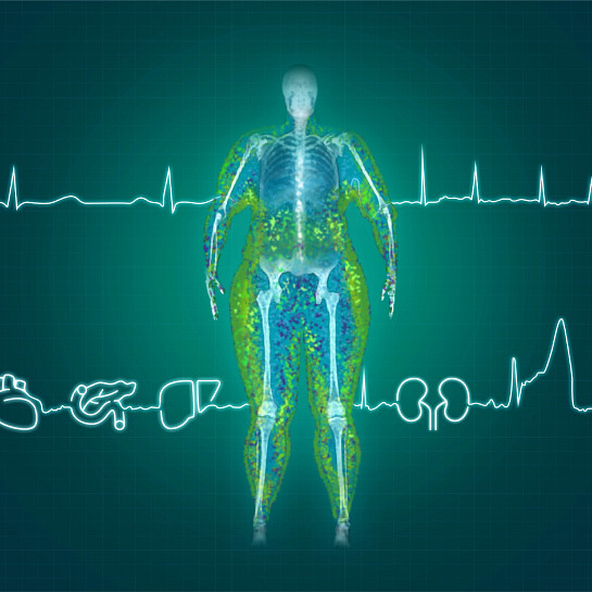 obesity scan person
