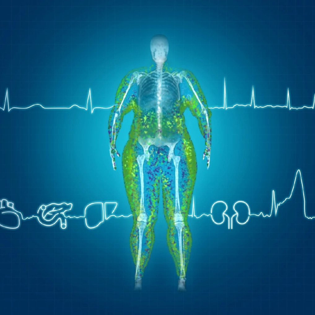 obesity_scan_icons