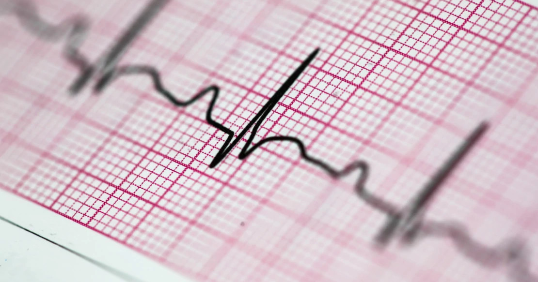 hearbeat_cardiogram