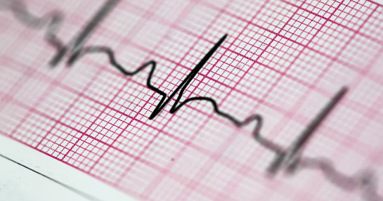 hearbeat_cardiogram