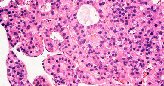 Oncology care in commercial positioning