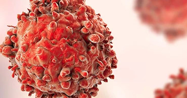 Microscopic view of malignant cellular structures