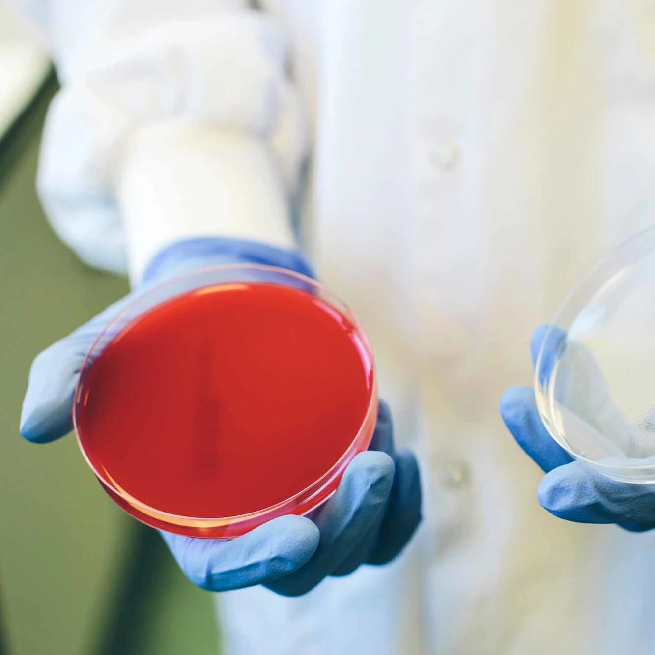 Laboratory cancer cell culture examination