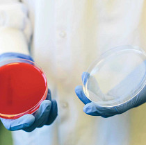 Laboratory cancer cell culture examination