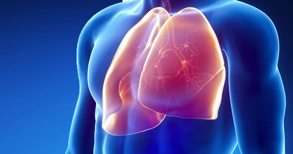 Respiratory disease treatment overview