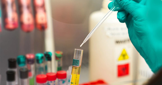 lab sampling