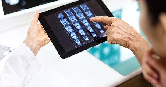doctor tablet scan multiple myloema