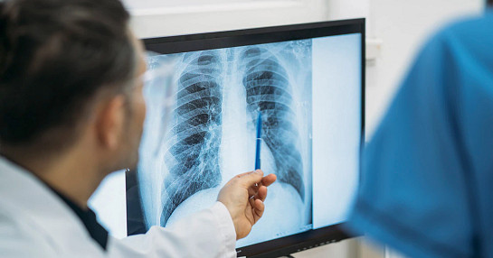pulmonary_scan_lungs