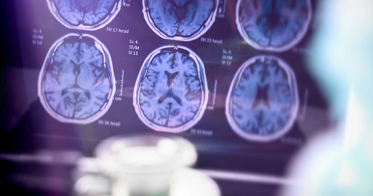 website thumbnail image, CNS